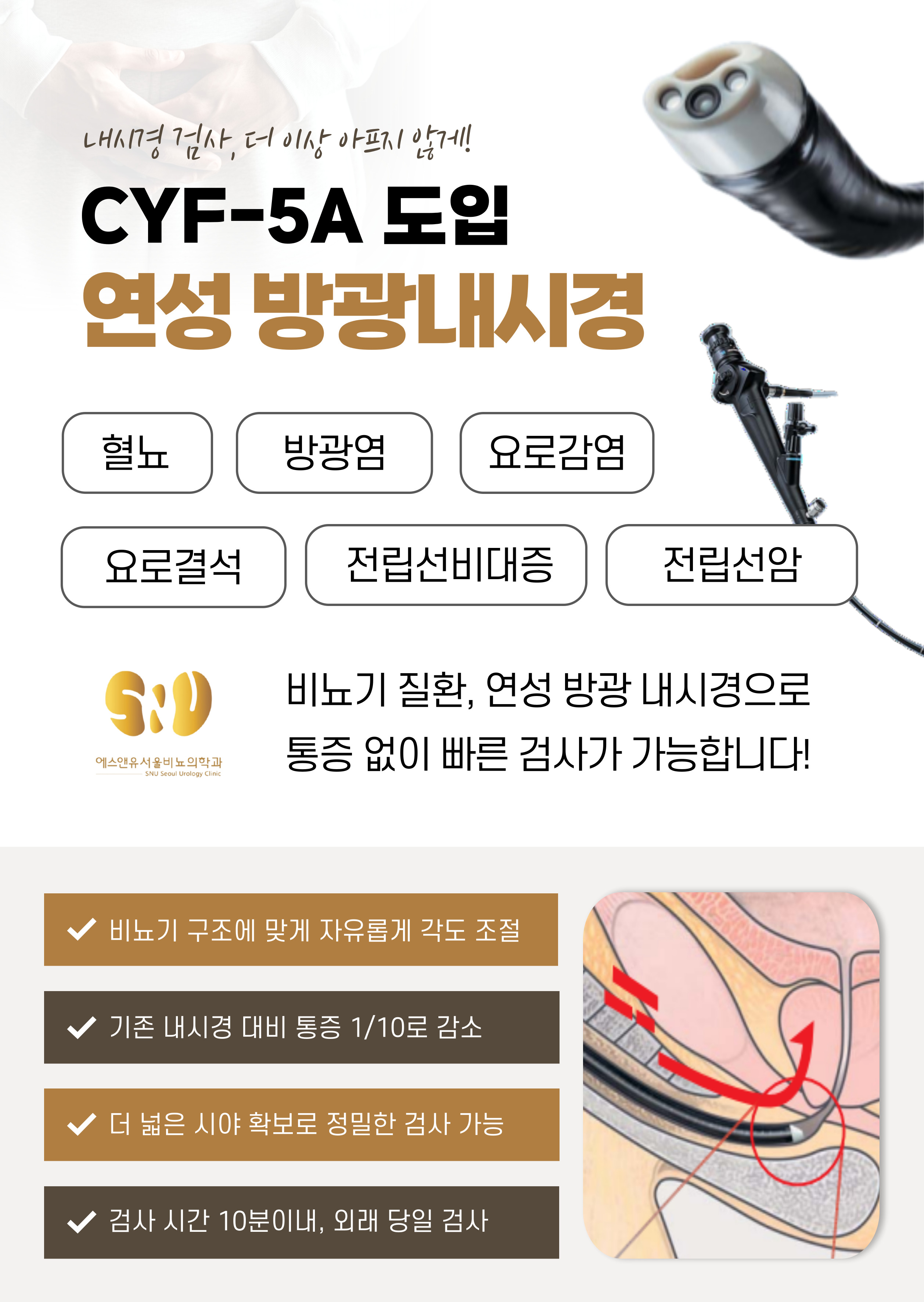 연성내시경